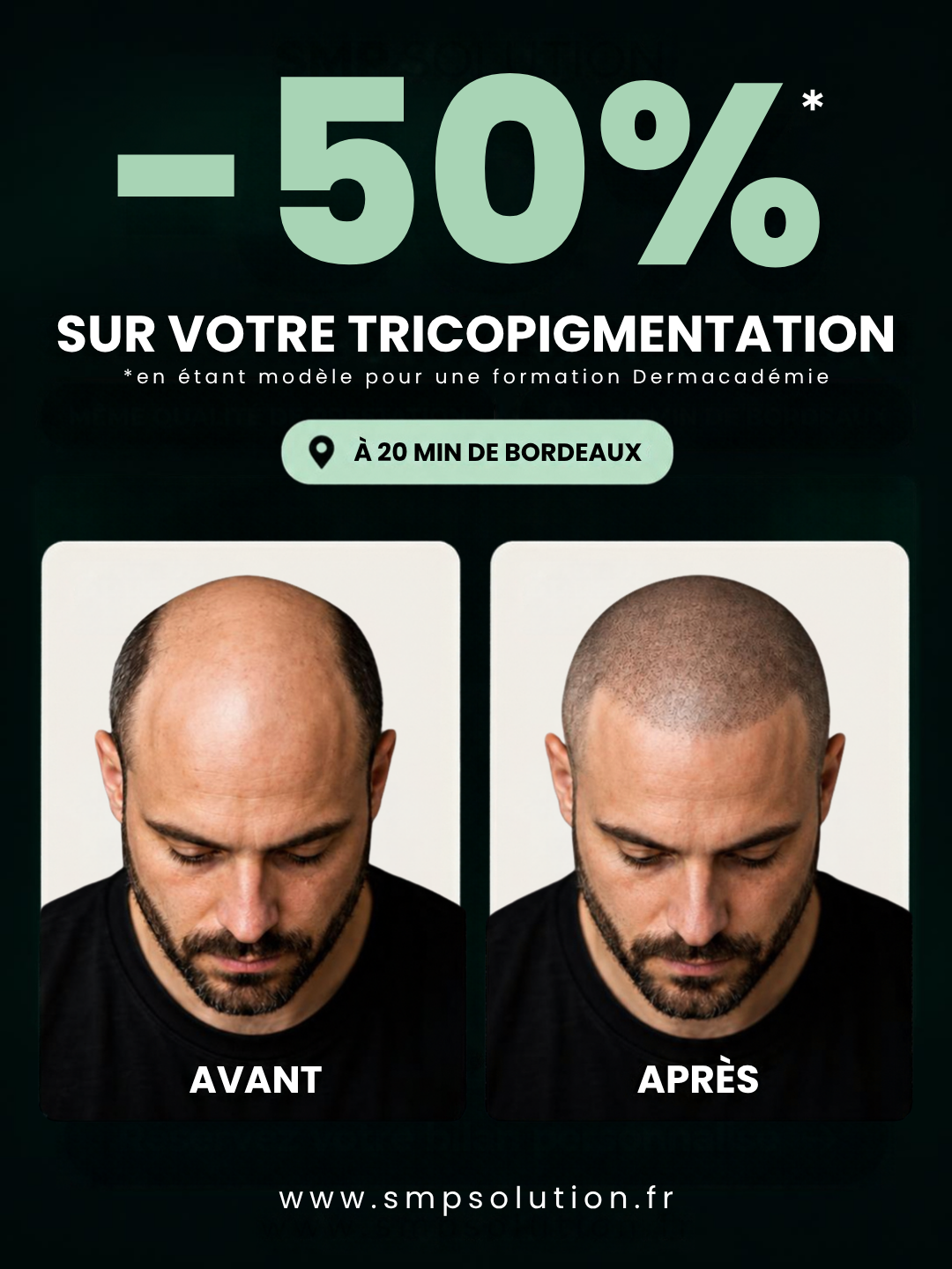 Offre modèle tricopigmentation Dermacadémie à moins 50 %