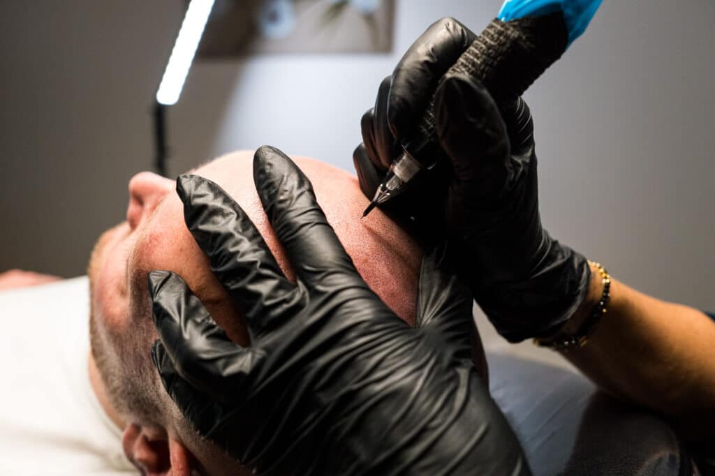 Tricopigmentation capillaire séance Noëmie